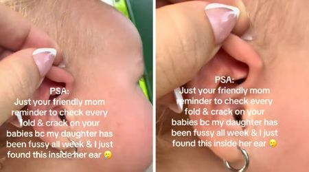 Toddler mom shares a life-saving reminder to check your baby’s ears often: ‘Take her to the doc...’